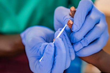 Kenya Adopts MFT Strategy in Major Shift Against Malaria